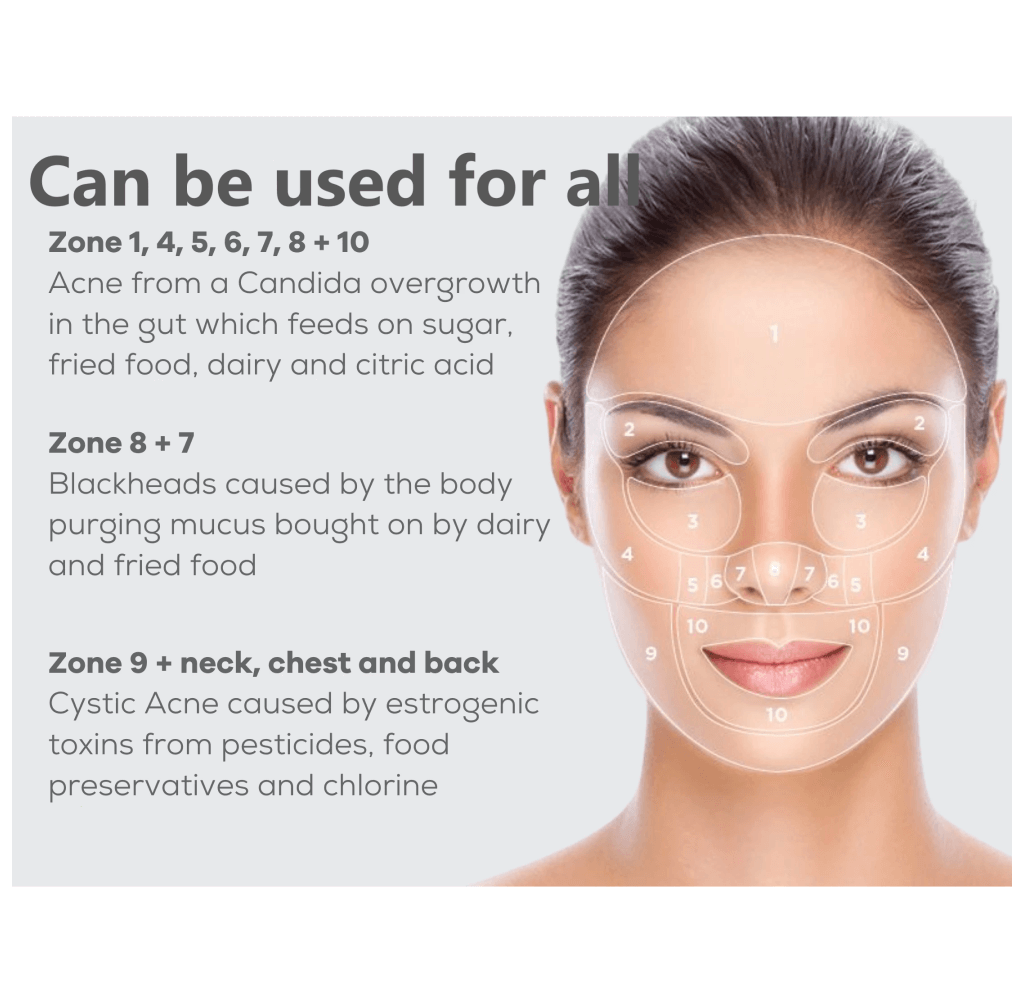 ACNELYSE%0.025 Skin Cream Acne Treatment Skin Renewal Anti Aging Cream For Daily Use Tretinoin 0.025