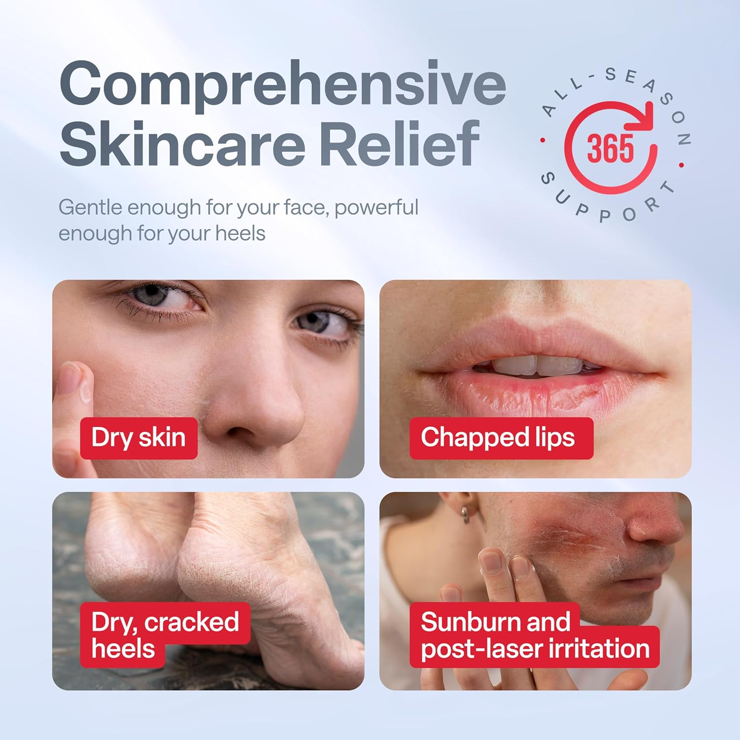 Retimax 1500 Retinol – Retinol %0.045 Care for Dry and Sensitive Skin & Skin Renewing, Moisturizing Formula – 30g