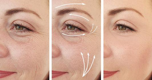 Why Patience, Natural Ingredients, and the Right Products Matter in Skincare