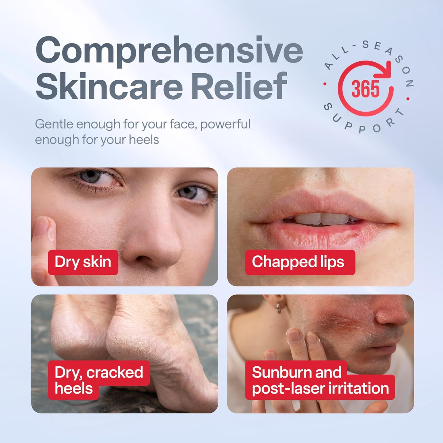 Retimax 1500 Retinol – Retinol %0.045 Care for Dry and Sensitive Skin & Skin Renewing, Moisturizing Formula – 30g