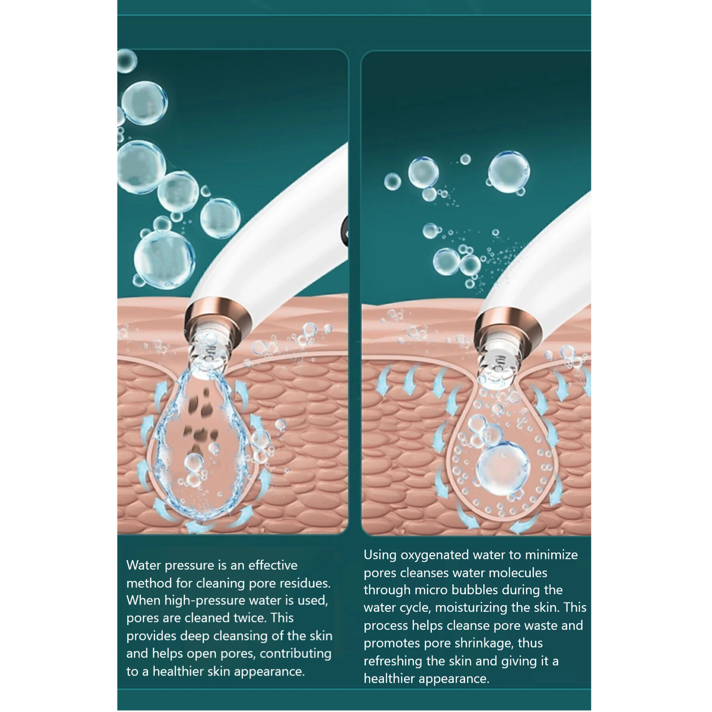 Vacuum Blackhead Remover – Rechargeable, 6 Heads, Anti-Acne & Comedone Facial Care