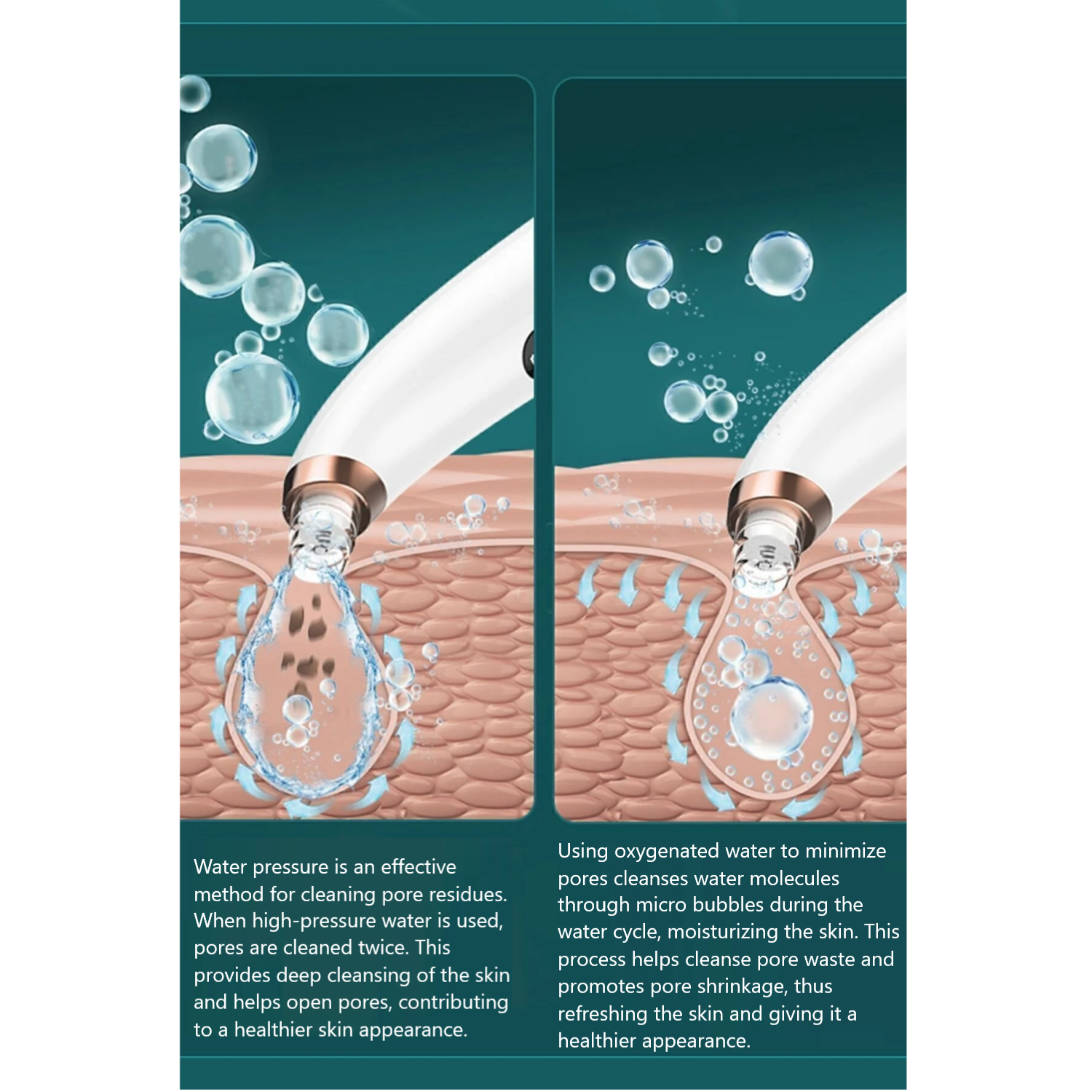 Vacuum Blackhead Remover – Rechargeable, 6 Heads, Anti-Acne & Comedone Facial Care