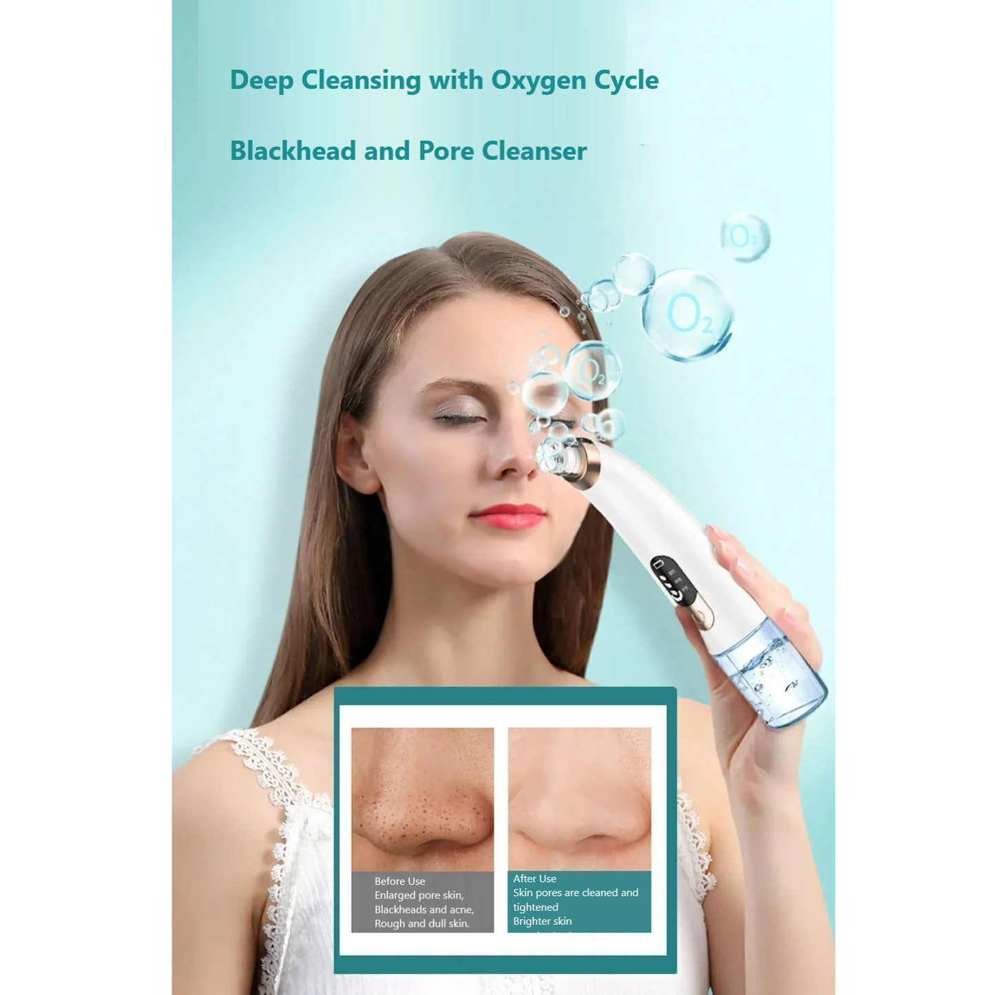 Vacuum Blackhead Remover – Rechargeable, 6 Heads, Anti-Acne & Comedone Facial Care